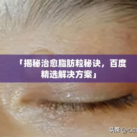 「揭秘治愈脂肪粒秘诀，百度精选解决方案」